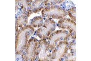 Immunohistochemistry of CAD in mouse kidney tissue with CAD antibody at 2 μg/ml. (DFFB 抗体)