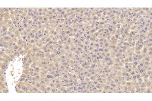 Immunohistochemistry (IHC) image for anti-Complement Component C4b (C4b) (AA 126-366) antibody (ABIN7433423)