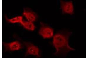 anti-Phosphoinositide 3 Kinase, p85 alpha/gamma (PI3K p85a/g) (pTyr199), (pTyr467) antibody