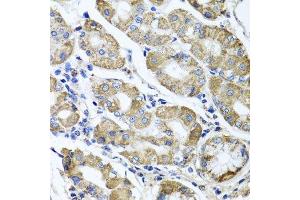 Immunohistochemistry of paraffin-embedded human stomach using ETFA antibody. (ETFA 抗体  (AA 1-333))