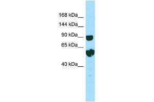 WB Suggested Anti-RPTN Antibody Titration: 1. (Repetin 抗体  (C-Term))