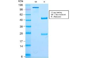 SDS-PAGE Analysis Purified Neurofilament Rabbit Monoclonal Antibody (NEFL/2983R). (Recombinant NEFL 抗体)
