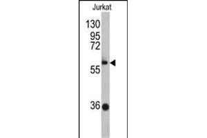 Western Blotting (WB) image for anti-Zinc Finger and BTB Domain Containing 2 (ZBTB2) (AA 335-364), (C-Term) antibody (ABIN390710)