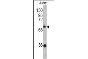 Western blot analysis of ZBTB2 antibody (C-term) (ABIN390710 and ABIN2840992) in Jurkat cell line lysates (35 μg/lane). (ZBTB2 抗体  (C-Term))
