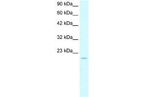 WB Suggested Anti-ARNTL Antibody Titration:  5. (ARNTL 抗体  (N-Term))