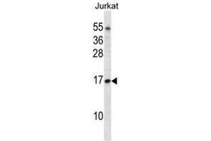 TCEB1 Antibody (C-term) western blot analysis in Jurkat cell line lysates (35 µg/lane). (TCEB1 抗体  (C-Term))