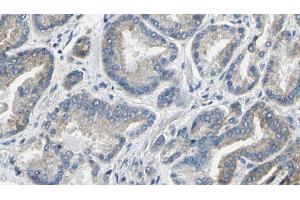 ABIN6274207 at 1/100 staining Human prostate tissue by IHC-P. (DTYMK 抗体  (Internal Region))