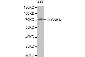 Western Blotting (WB) image for anti-Chloride Channel Ka (CLCNKA) antibody (ABIN1871886) (CLCNKA 抗体)