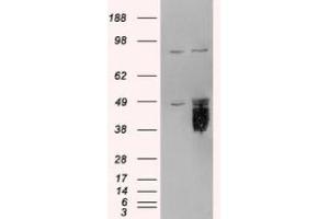 Image no. 2 for anti-Tissue Factor Pathway Inhibitor (Lipoprotein-Associated Coagulation Inhibitor) (TFPI) (C-Term) antibody (ABIN374077) (TFPI 抗体  (C-Term))