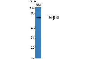 Western Blotting (WB) image for anti-Transforming Growth Factor, beta Receptor II (70/80kDa) (TGFBR2) (Internal Region) antibody (ABIN6284592)