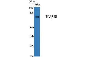 Western Blotting (WB) image for anti-Transforming Growth Factor, beta Receptor II (70/80kDa) (TGFBR2) (Internal Region) antibody (ABIN3187248) (TGFBR2 抗体  (Internal Region))