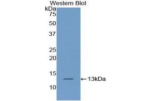 Detection of Recombinant PABPC1L, Human using Polyclonal Antibody to Poly A Binding Protein Cytoplasmic 1 Like Protein (PABPC1L) (PABPC1L 抗体  (AA 514-612))