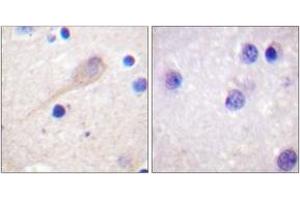 Immunohistochemistry (IHC) image for anti-Parkinson Protein 2, E3 Ubiquitin Protein Ligase (Parkin) (PARK2) (AA 101-150) antibody (ABIN2888688) (Parkin 抗体  (AA 101-150))