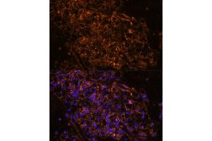 Immunofluorescence (IF) image for anti-Sodium Channel, Nonvoltage-Gated 1, gamma (SCNN1G) (AA 100-250) antibody (ABIN7270387)