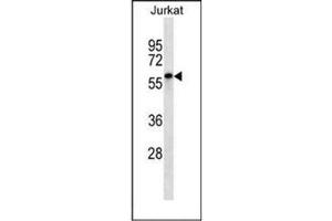Western blot analysis of ENOX2 Antibody (N-term) in Jurkat cell line lysates (35ug/lane). (ENOX2 抗体  (N-Term))