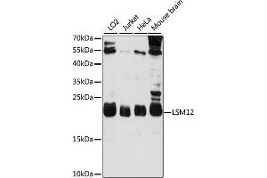 Western blot analysis of extracts of various cell lines, using LSM12 antibody (ABIN7268307) at 1000 dilution. (LSM12B 抗体  (AA 1-195))
