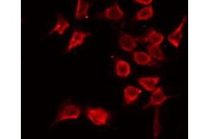 Immunofluorescence (fixed cells) (IF/ICC) image for anti-Protein tyrosine Phosphatase, Non-Receptor Type 1 (PTPN1) (N-Term) antibody (ABIN6264512)