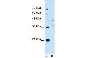 EVI2B antibody used at 2. (EVI2B 抗体  (Middle Region))