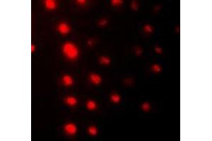 Immunofluorescent analysis of ZNF7 staining in HeLa cells. (ZNF7 抗体  (N-Term))