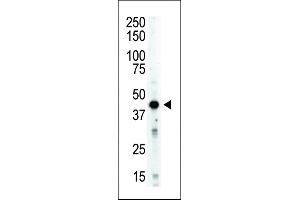 Antibody is used in Western blot to detect STK12 in mouse spleen tissue lysate. (Aurora Kinase B 抗体  (AA 283-313))