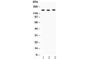 Western blot testing of ACE antibody and (1) HeLa, (2) A549 and (3) 22RV1 lysate. (Angiotensin I Converting Enzyme 1 抗体  (Middle Region))
