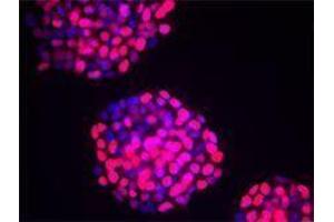 Immunofluorescence (IF) image for anti-Tumor Protein P53 (TP53) antibody (ABIN2664005) (p53 抗体)