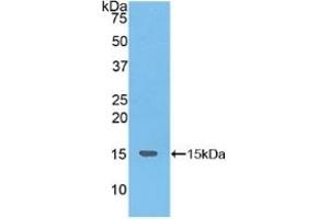 Tachykinin 3 抗体  (AA 23-121)