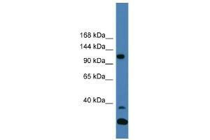 WB Suggested Anti-TYK2 Antibody Titration:  0. (TYK2 抗体  (C-Term))