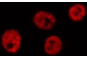 ABIN6276851 staining HepG2? (LIG4 抗体  (C-Term))