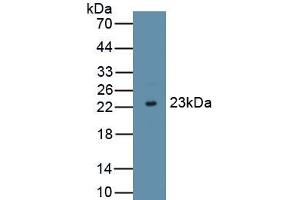 Detection of Recombinant IFNt, Bovine using Polyclonal Antibody to Interferon Tau (IFNt) (Interferon Tau 抗体  (AA 24-195))