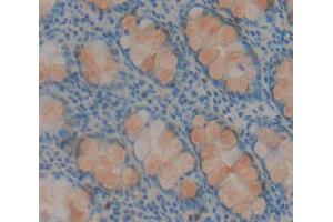 Used in DAB staining on fromalin fixed paraffin- embedded rectum tissue (HABP2 抗体  (AA 24-560))