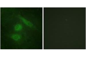 Immunofluorescence analysis of HeLa cells, using IRF3 (Ab-385) Antibody. (IRF3 抗体  (AA 351-400))