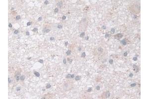Immunohistochemistry (IHC) image for anti-NADH Dehydrogenase (Ubiquinone) Fe-S Protein 1, 75kDa (NADH-Coenzyme Q Reductase) (NDUFS1) (AA 524-727) antibody (ABIN7441598)