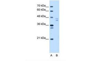 Image no. 1 for anti-Proteasome (Prosome, Macropain) 26S Subunit, Non-ATPase, 11 (PSMD11) (N-Term) antibody (ABIN324265)