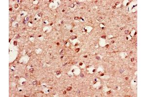 Immunohistochemistry of paraffin-embedded human brain tissue using ABIN7157902 at dilution of 1:100 (LANCL1 抗体  (AA 50-150))