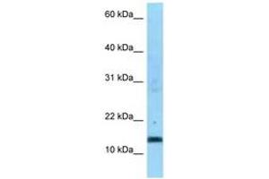 Image no. 1 for anti-Succinate Dehydrogenase Complex, Subunit C, Integral Membrane Protein, 15kDa (SDHC) (AA 59-108) antibody (ABIN6748189) (SDHC 抗体  (AA 59-108))