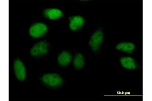 Immunofluorescence of purified MaxPab antibody to ZNF503 on HeLa cell. (ZNF503 抗体  (AA 1-646))