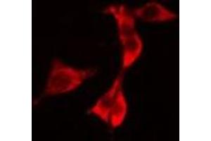 ABIN6277226 staining 293 cells by IF/ICC. (RIPK2 抗体  (N-Term))