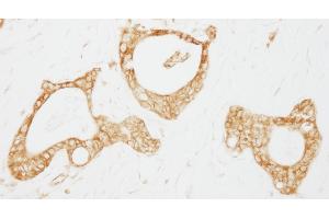 anti-Ubiquitin Specific Peptidase 3 (USP3) (AA 471-521) antibody
