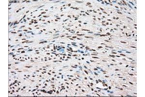 Image no. 7 for anti-TYRO3 Protein Tyrosine Kinase (TYRO3) antibody (ABIN1501608)