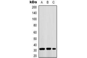 Western blot analysis of GPR40 expression in K562 (A), mouse kidney (B), COS7 (C) whole cell lysates. (FFAR1 抗体)