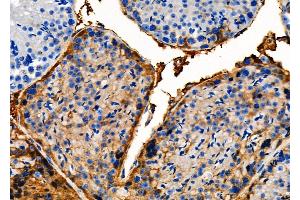 ABIN6261082 and ABIN6279333 at 1/100 staining Mouse testis tissue by IHC-P. (CTH 抗体  (N-Term))