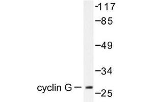 Image no. 1 for anti-Cyclin G1 (CCNG1) antibody (ABIN265382) (Cyclin G1 抗体)