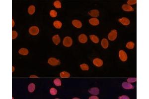 Immunofluorescence analysis of C6 cells using TADA3 Polyclonal Antibody at dilution of 1:100. (TADA3L 抗体)