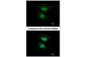 Immunofluorescence (IF) image for anti-NGFI-A Binding Protein 2 (EGR1 Binding Protein 2) (NAB2) antibody (ABIN2855660)