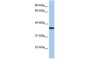 LDLRAP1 antibody used at 1 ug/ml to detect target protein. (LDLRAP1 抗体  (N-Term))