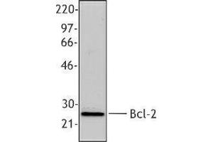 Western Blotting (WB) image for anti-B-Cell CLL/lymphoma 2 (BCL2) antibody (ABIN2666265) (Bcl-2 抗体)