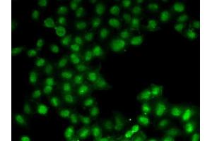 Immunofluorescence analysis of U2OS cells using C11orf30 antibody (ABIN6127846, ABIN6137723, ABIN6137725 and ABIN6221740). (EMSY 抗体  (AA 1153-1322))
