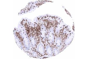 Immunohistochemistry (IHC) image for anti-Protein tyrosine Phosphatase, Receptor Type, C (PTPRC) antibody (ABIN7477413)