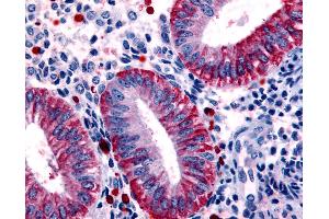Anti-DKK1 antibody IHC of human uterus, endometrium. (DKK1 抗体  (Internal Region))